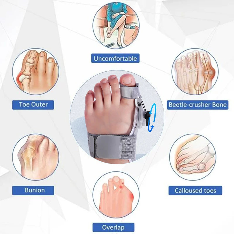 Bunion Corrector – Adjustable Toe Separator & Straightener for Hallux Valgus Relief (Unisex)