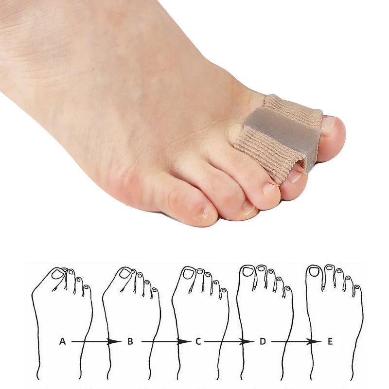 Toe Separator Silicone Pedicure Tools – Bunion Corrector & Gel Insoles for Shoes (1/2/4pcs)