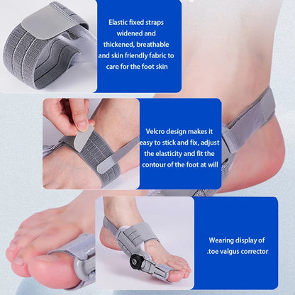 Bunion Corrector – Adjustable Toe Separator & Straightener for Hallux Valgus Relief (Unisex)